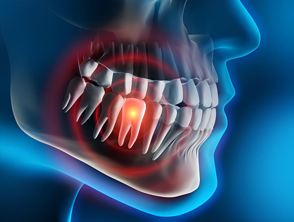 Teeth image - Emergency dentist Potters Bar